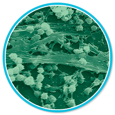 Staphylococcus Aureus Biofilm Staphylococcus Aureus Biofilm