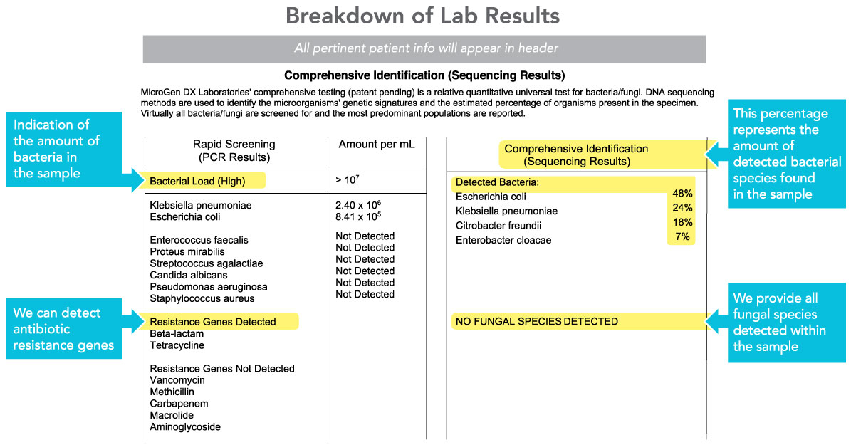 Urology Empowering Urologists with DNA Level Certainty. MicroGen