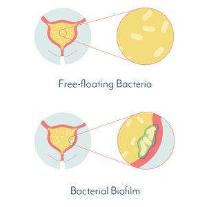 Live Uti Free On Microgendx Microgen Diagnostics