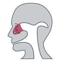 patient uti infection