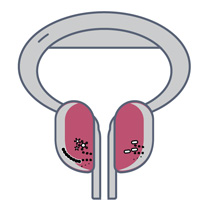 patient uti infection