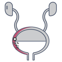 patient uti infection