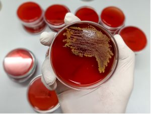 ngs vs standard urine culture