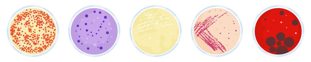 lab culture fails to diagnose pji