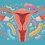 The Hidden Microbial Factor Behind 57% of Premature IUD Removals